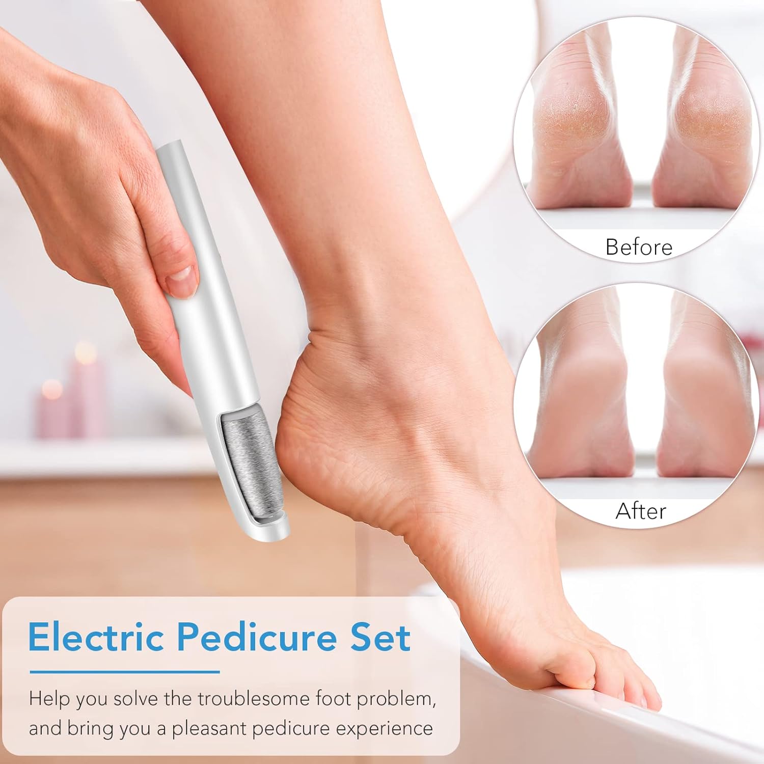 Rechargeable Electric Foot File – Smooth Heels, Anytime Anywhere